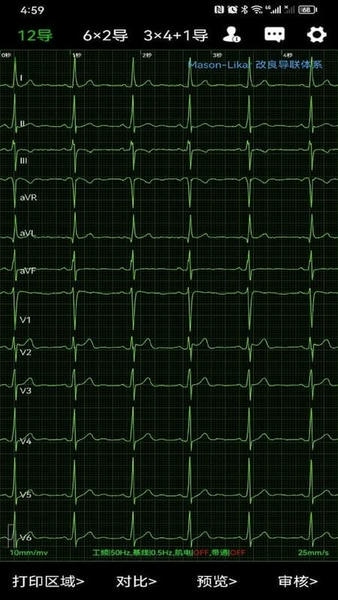 心电一张网下载 v1.0.41 0