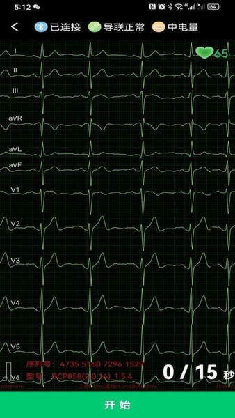 心电一张网下载 v1.0.41 2
